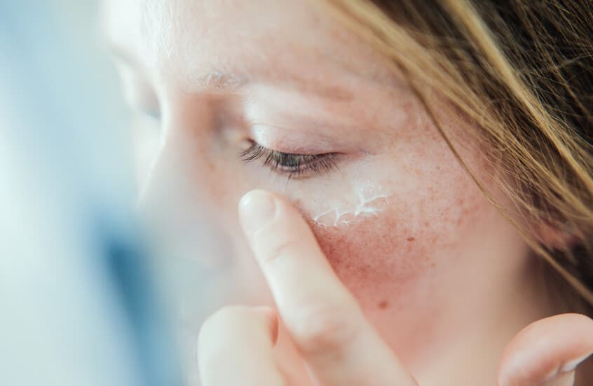 "Der Winterunrat".. Wie kaltes Wetter Ihre Haut beeinflusst und wie man sich davor schützt
