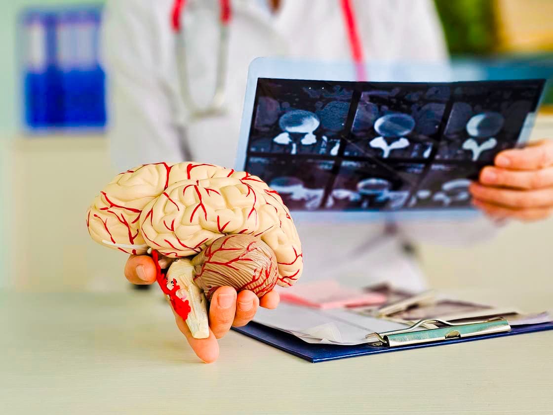 Surprise médicale : La maladie d'Alzheimer est-elle cérébrale ou immunitaire ?